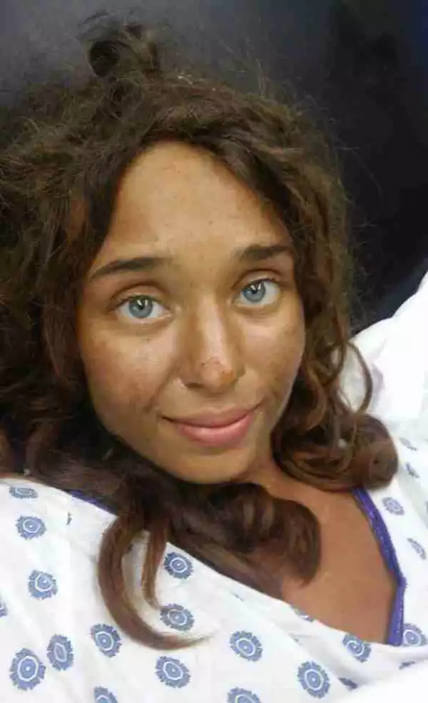 Woman Found Naked After Going Missing For A Month (Photo)